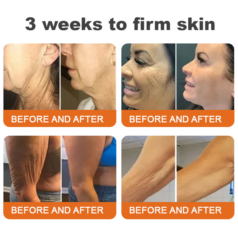 🎁Buy 3 Get 1 Free - Advanced Lift