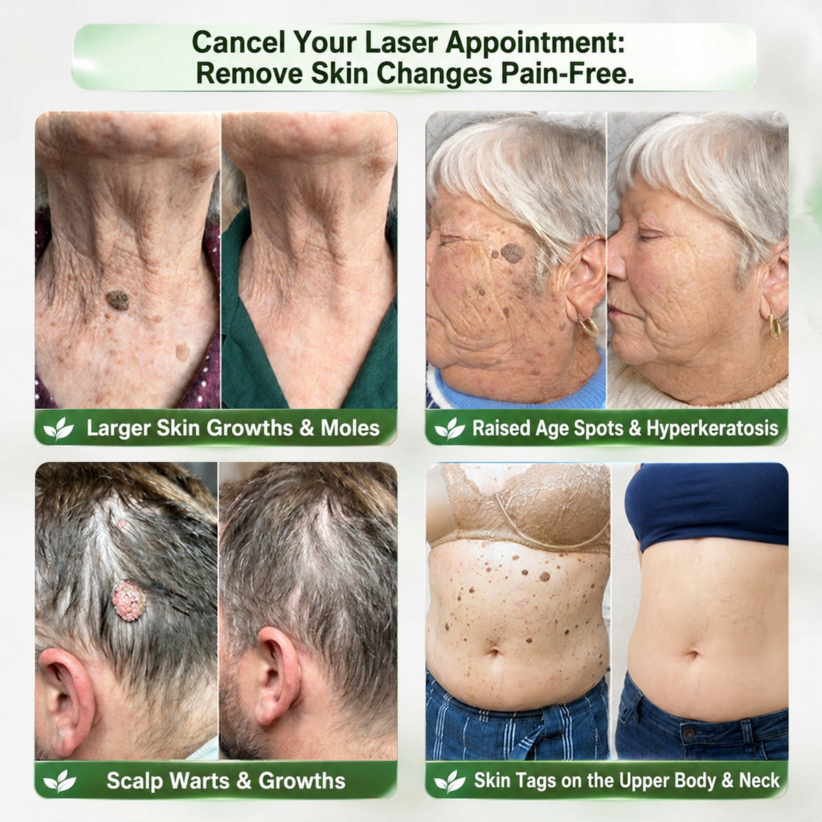 InnoMedix® 🧬𝑷𝑫𝑹𝑵 𝑨𝒏𝒕𝒊-𝑨𝒈𝒊𝒏𝒈 & 𝑻𝒂𝒓𝒈𝒆𝒕𝒆𝒅 𝑺𝒌𝒊𝒏 𝑹𝒆𝒏𝒆𝒘𝒂𝒍 𝑺𝒕𝒊𝒄𝒌 (𝑯𝒆𝒍𝒑𝒔 𝒗𝒊𝒔𝒊𝒃𝒍𝒚 𝒔𝒎𝒐𝒐𝒕𝒉 𝒘𝒓𝒊𝒏𝒌𝒍𝒆𝒔, 𝒔𝒖𝒑𝒑𝒐𝒓𝒕𝒔 𝒂 𝒇𝒊𝒓𝒎𝒆𝒓-𝒍𝒐𝒐𝒌𝒊𝒏𝒈 𝒔𝒌𝒊𝒏 𝒂𝒑𝒑𝒆𝒂𝒓𝒂𝒏𝒄𝒆 & 𝒊𝒎𝒑𝒓𝒐𝒗𝒆𝒔 𝒕𝒉𝒆 𝒂𝒑𝒑𝒆𝒂𝒓𝒂𝒏𝒄𝒆 𝒐𝒇 𝒗𝒊𝒔𝒊𝒃𝒍𝒆 𝒔𝒌𝒊𝒏 𝒔𝒑𝒐𝒕𝒔)