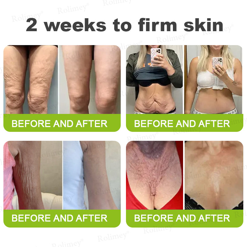 🚚Buy 4 Get 2 Free - Firming Boost