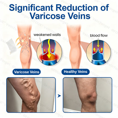 🇺🇸👨‍⚕️✨🌿𝐇𝐞𝐚𝐥𝐫𝐢𝐳𝐞® VeinTarget Microneedle Patch⚡Instant Relief, Long-Term Results