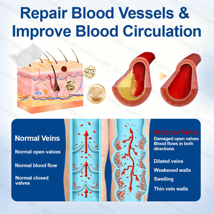 🇺🇸👨‍⚕️✨🌿𝐇𝐞𝐚𝐥𝐫𝐢𝐳𝐞® VeinTarget Microneedle Patch⚡Instant Relief, Long-Term Results